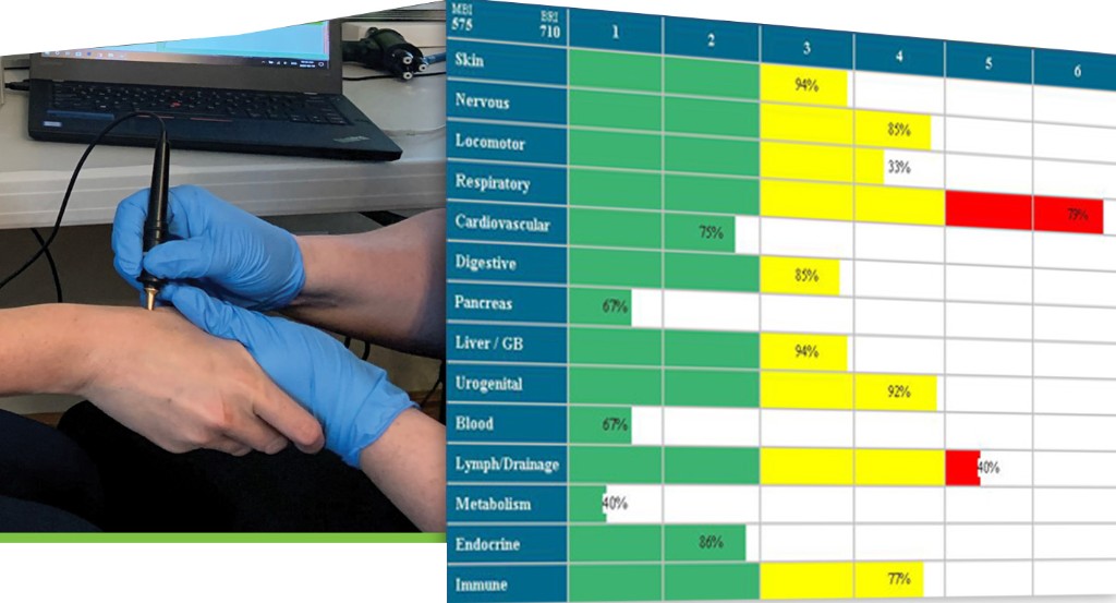 A gloved hand holds a stylus at the first proximal metacarpal of the thumb while a chart lists body systems with green, yellow, and red bars.